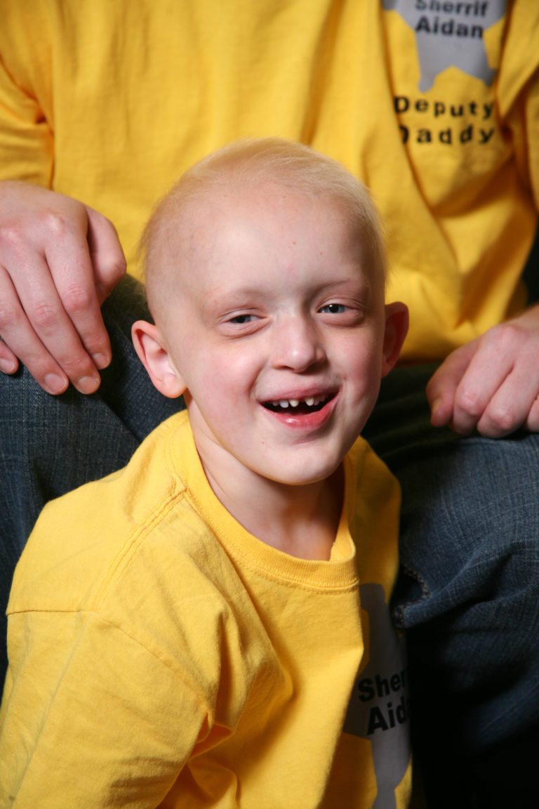 Top 10* Most Common Ectodermal Dysplasias - NFED