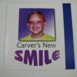 Carver's New Smile