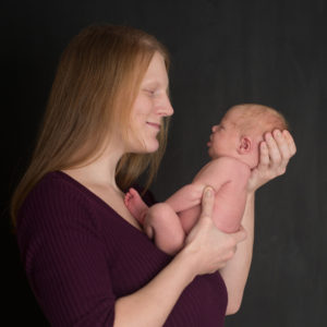 A new mom with Clouston syndrome holds her infant daughter who also has the condition.