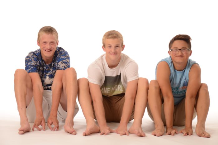 Three young  men show their hands and feet, which are all missing fingers and toes due to ectrodactyly. The boys are affected by EEC syndrome.