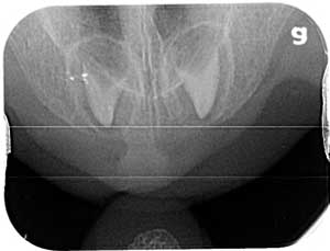 Tooth bud x-ray