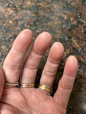 This photo shows the left hand of a woman with palm side up. She's wearing three gold rings. You can see the dry skin on the fingertips but can't easily see fingerprints.