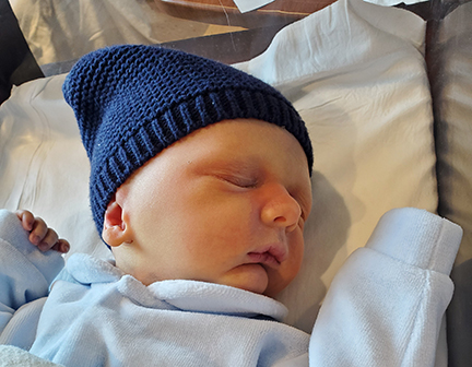 The baby affected by XLHED is wearing a blue hat and is lying in a baby bed sleeping. 