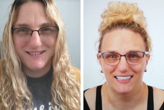 Jessica shows off her smile before and after getting dental treatment.