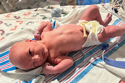 Matthew right after he was born at the hospital in just a diaper.