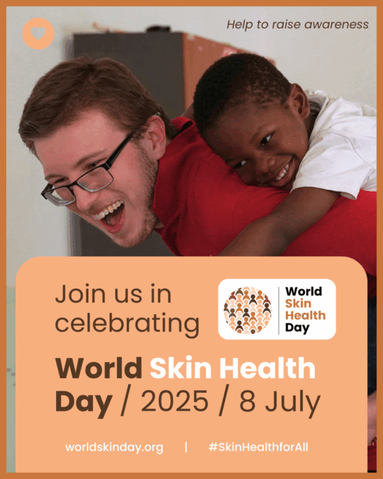World Skin Health Day and Link to https://worldskinday.org/