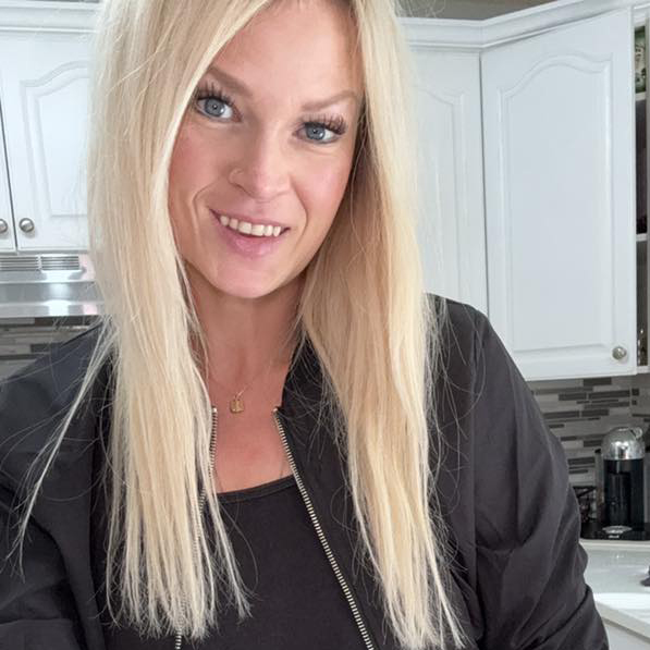 This image has an empty alt attribute; its file name is Tavin-ectodermal-dysplasia-1.jpg