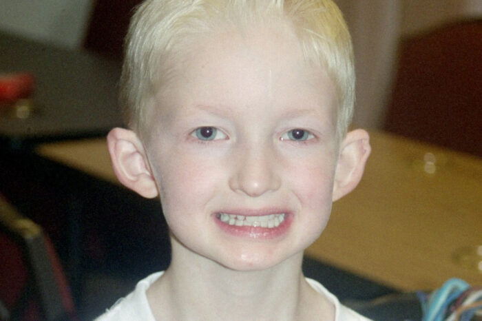This is a headshot of a young boy with white blonde hair who is smiling and showing his dentures. 