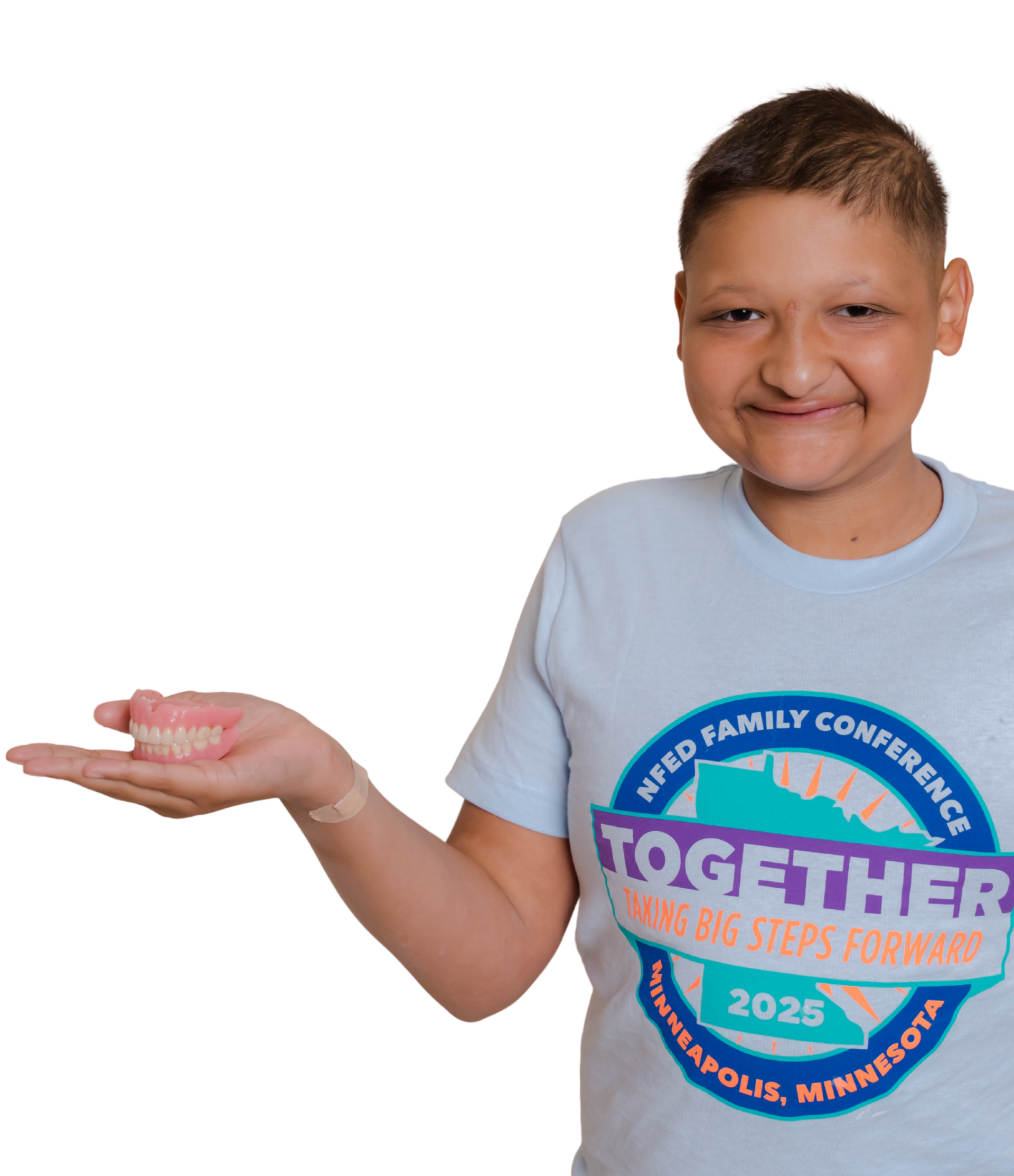 National Foundation for Ectodermal Dysplasias | NFED