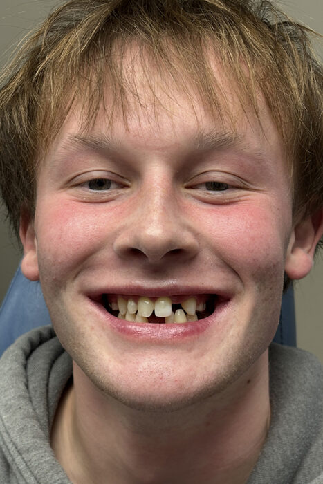 This is a head shot of Finnegan.  he's missing a tooth on top and on bottom. He's wearing a gray hoodie.