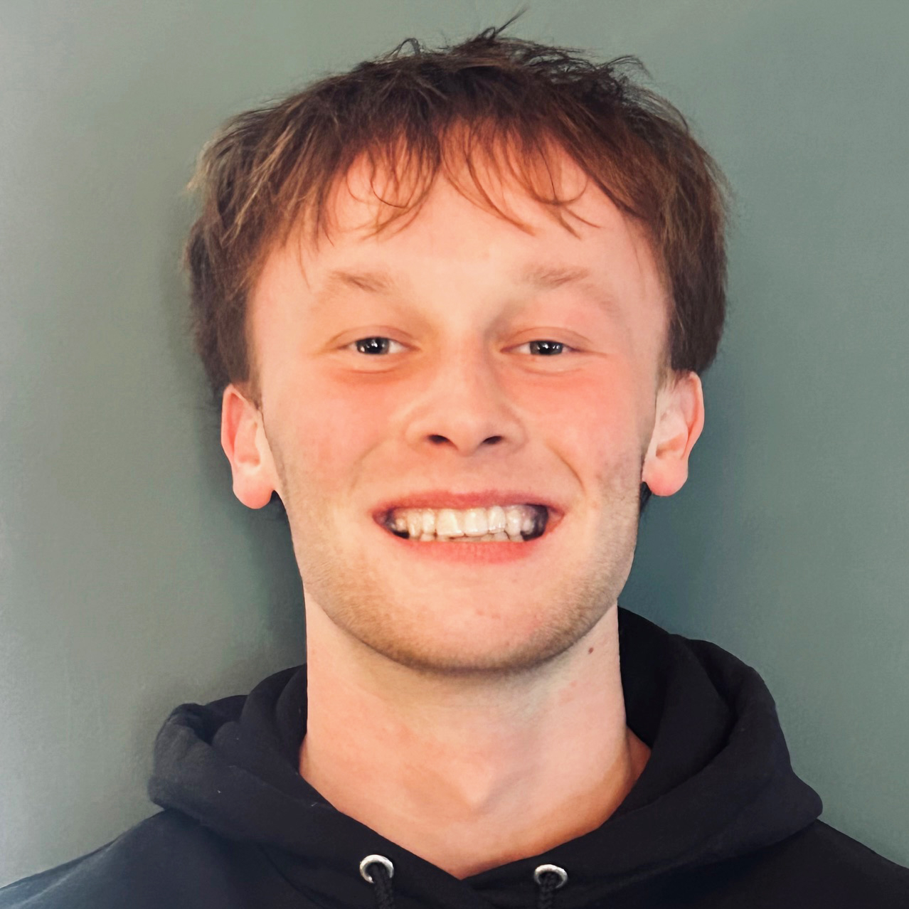 National Foundation for Ectodermal Dysplasias | NFED