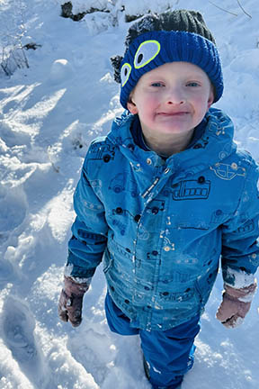 A young boy with XLHED is standing in the snow. he's wearing his winter coat, hat and gloves.