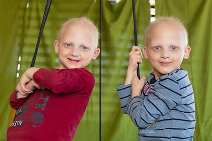 Twin boys affected by X-linked hypohidrotic ectodermal dysplasia are side by side holding on to ropes. One is wearing a red shirt and one is wearing a blue shirt. Both have sparse, white blonde hair. and are smiling.