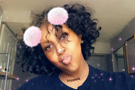 This is headshot of a young woman affected by EEC syndrome. She used a phone filter to put pink sparkles on the photo and two fuzzy pom poms in her hair.