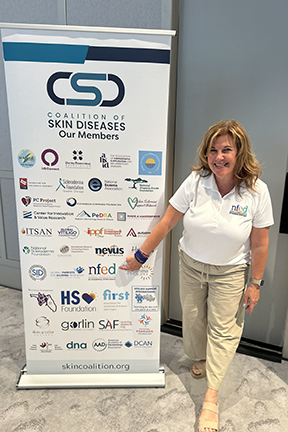 A woman in a white shirt and khaki pants points to the NFED logo on a banner for the Coalition of Skin Diseases.