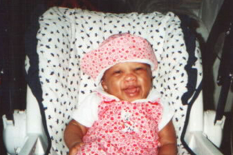 A smiling baby is sitting in a car seat. She's earing a pink hat and matching overalls with a white shirt. She's affected by EEC syndrome and has a repaired cleft lip.