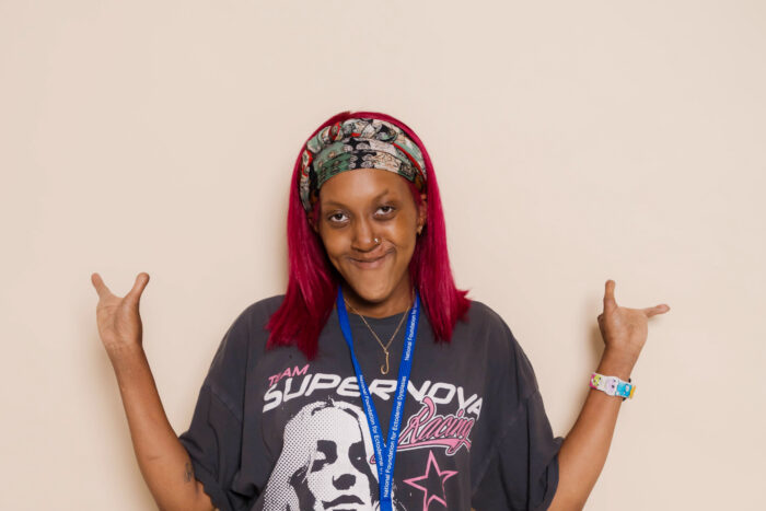 A headshot of a young Black woman affected by EEC syndrome. She's holding up her hands to show how she's affected by ectrodactyly. She's wearing a wig with magenta hair. She has a head band on.