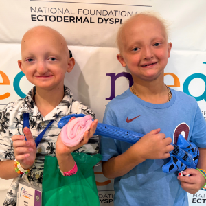 Two boys affected by ectodermal dysplasias stand side by side in front of an NFED banner. Both have sparse hair.