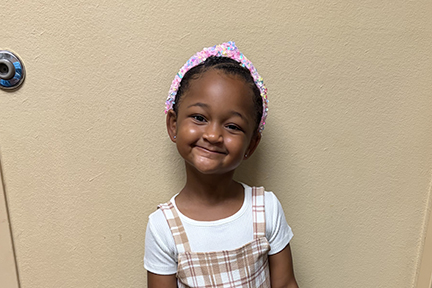 A young girl with ectodermal dysplasia is smiling. She's wearing a white t-shirt and a plaid jumper.