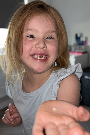 A young girl is smiling and holds her first missing tooth in the palm of her hand.
