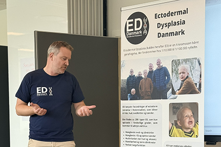 A man stands in front of a banner for the Ectodermal Dysplasia Danmark group. He's giving a presentation.